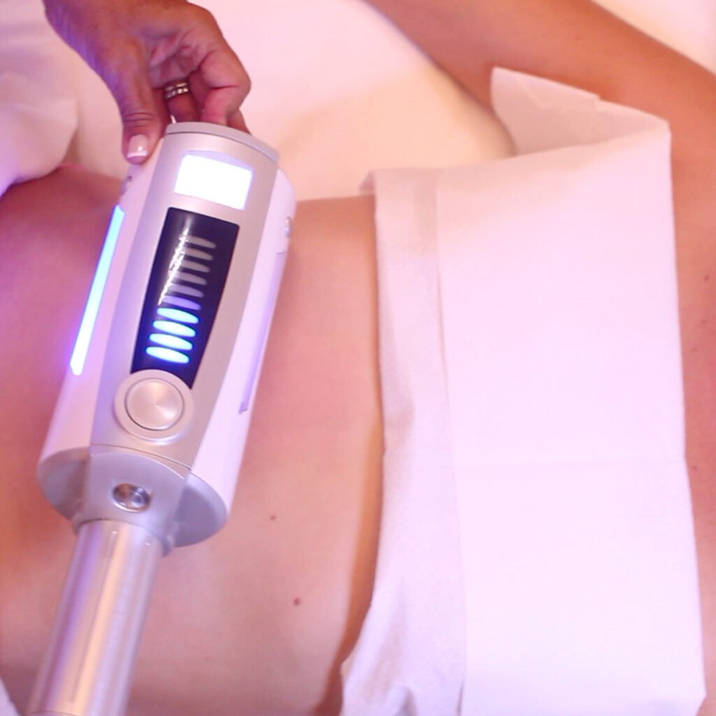 Rimodellare il corpo combattere la cellulite con Endospheres