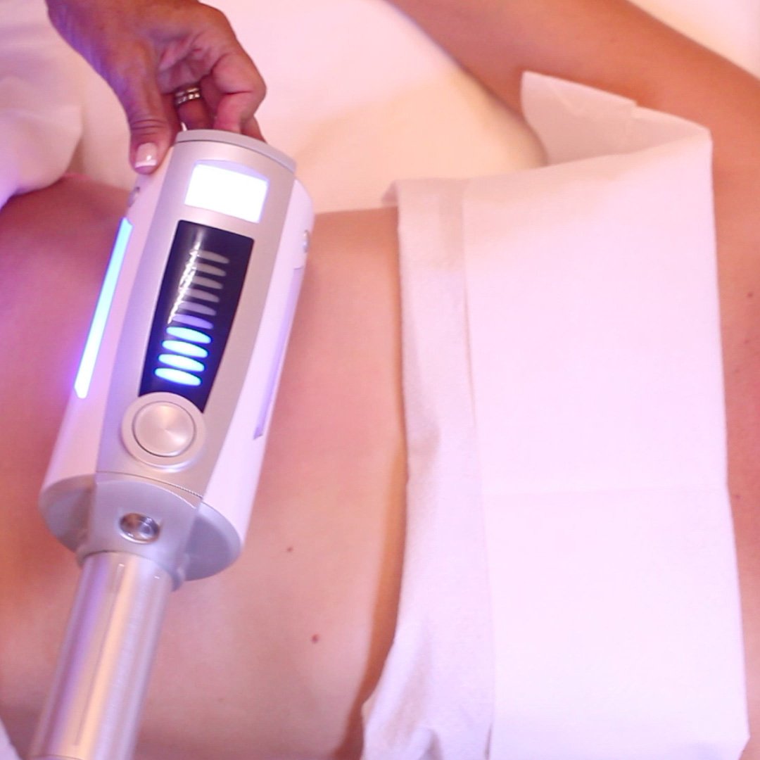 Rimodellare il corpo combattere la cellulite con Endospheres